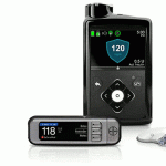 Pancreas artificial
